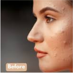 Before and After 1